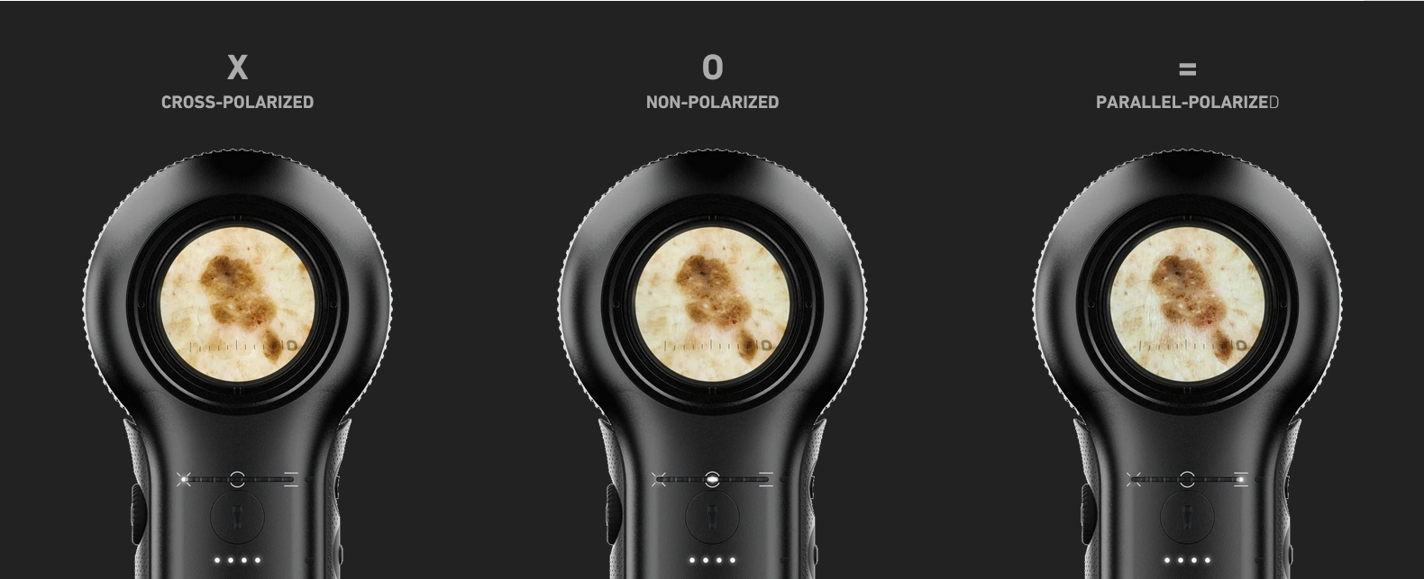 Dermlite DL5 en Chile