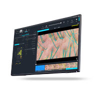 Dermatoscopia en Chile