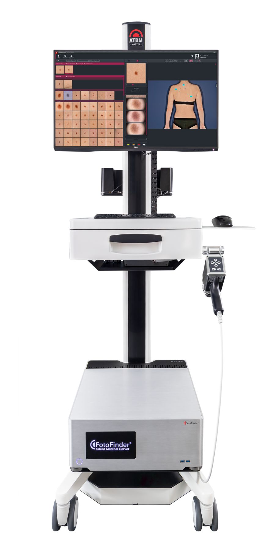 ATBM master en Chile