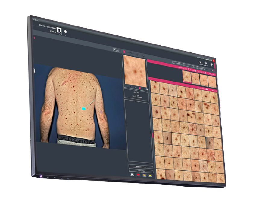 ATBM master en Chile