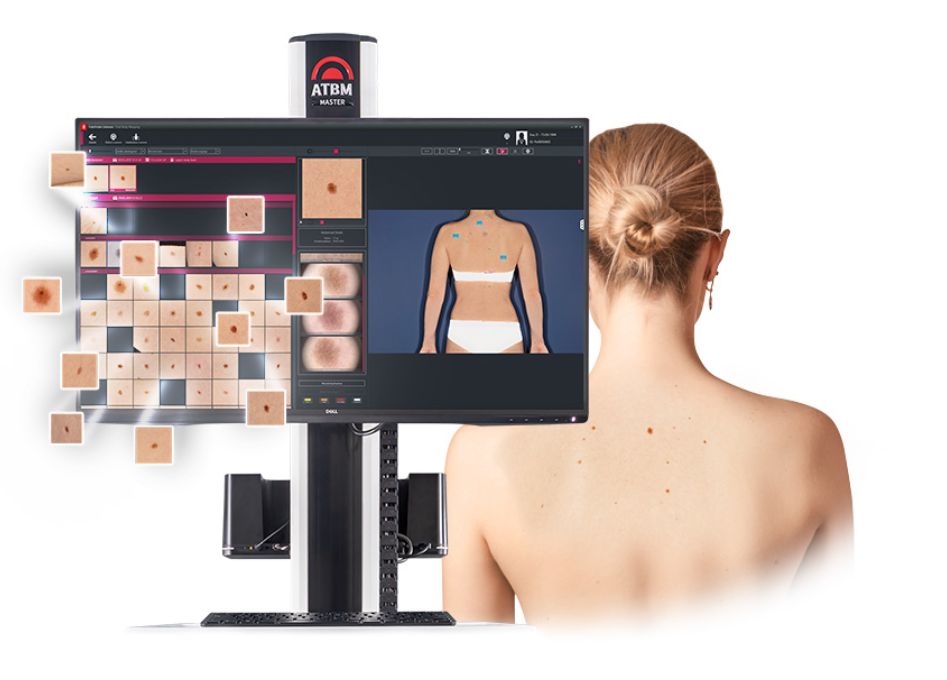 ATBM master en Chile